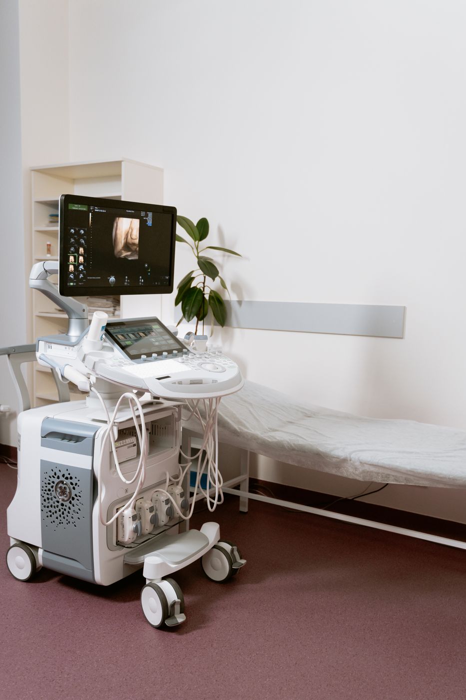 Ultrasound diagnostic system